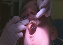Potreba po dežurni zobozdravstveni službi